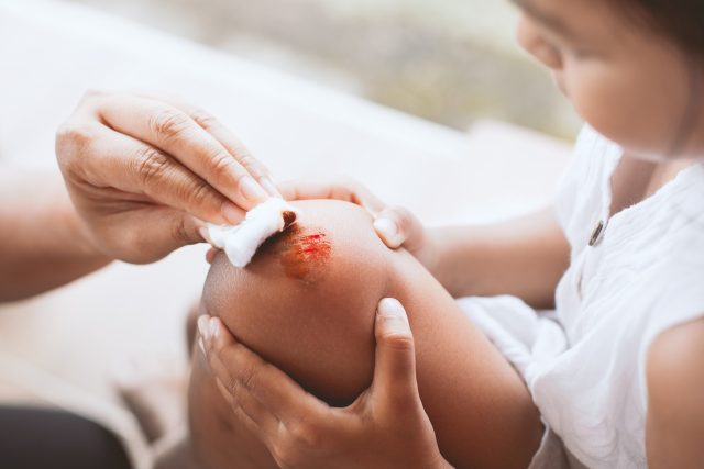 Parent,Helping,Her,Child,Perform,First,Aid,Knee,Injury,After