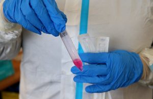Lenktynės su nauja koronaviruso atmaina įgyja pagreitį: uždaromos valstybių sienos, grįžta privalomos kaukės