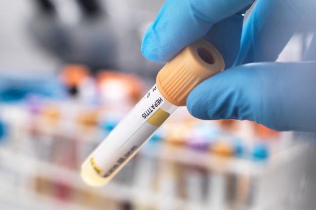 2_hepatitis-mystery-illness