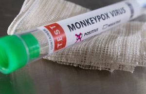 Airijoje užfiksuota apie 70 beždžionių raupų atvejų